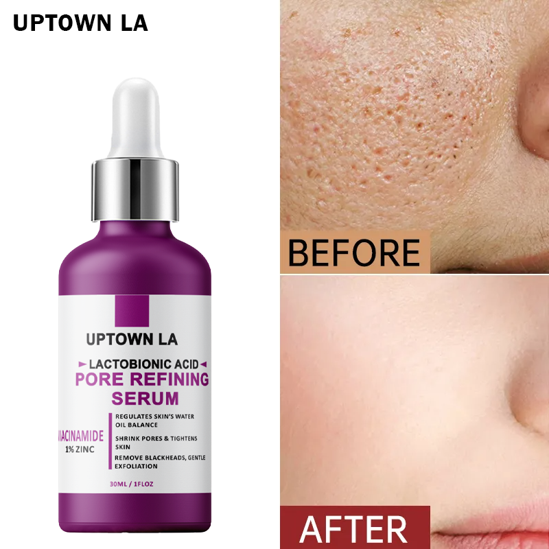 30ml Pore Refining Serum with  Acid & Niacinamide
