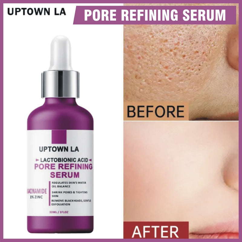 30ml Pore Refining Serum with  Acid & Niacinamide